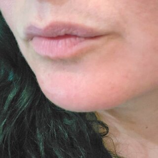 AbissoSvelato